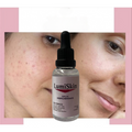 SERUM DESPIGMENTANTE LUMISKIN
